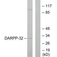 Anti-PPP1R1B