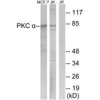 Anti-PRKCA (Ab-657)