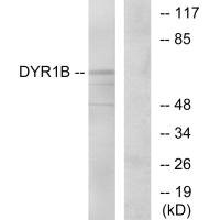 Anti-DYRK1B