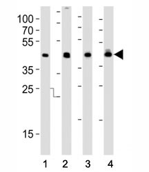 Anti-IDH1