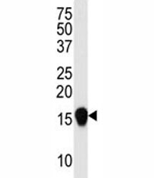 Anti-SUMO4 (V55 Mutant)