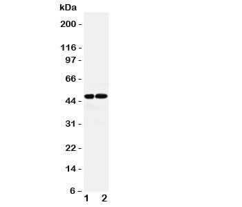 Anti-AVPR1A