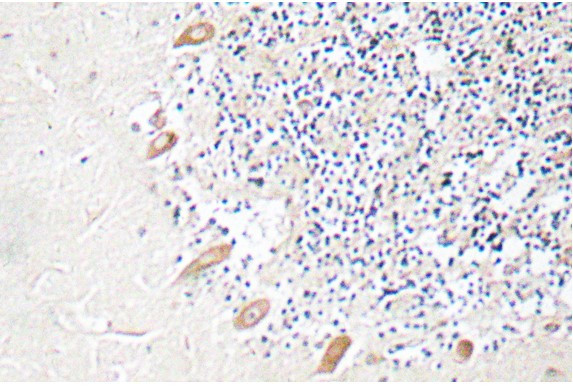 Anti-GABAA Receptor beta 1