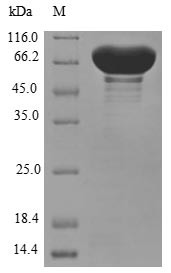 Cytochrome P450 11B1, mitochondrial (CYP11B1), human, recombinant