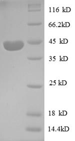 Insulin-like growth factor II protein (PP1446), partial, human, recombinant