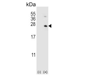 Anti-HPRT1 / HGPRT1