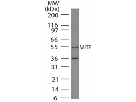 Anti-MITF, clone 21D1418