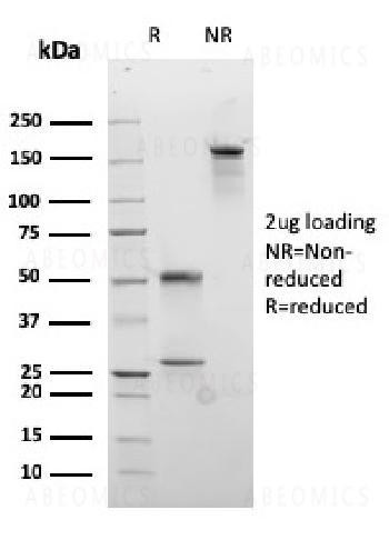 Anti-Desmocollin-2/3 Monoclonal Antibody (Clone: rDSC2/3437)