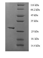 Glutathione peroxidase 1 (GPX1) (U49S), human, recombinant