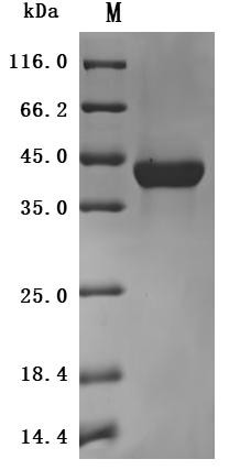 V-set and immunoglobulin domain-containing protein 4 (VSIG4), partial (Active), human, recombinant