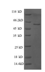 Glucosidase 2 subunit beta (PRKCSH), partial, human, recombinant