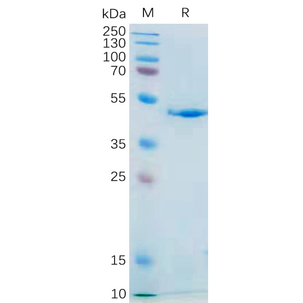 Human IL21 Protein, mFc Tag