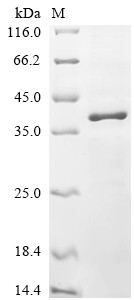 5-AMP-activated protein kinase catalytic subunit alpha-1 (Prkaa1), partial, mouse, recombinant