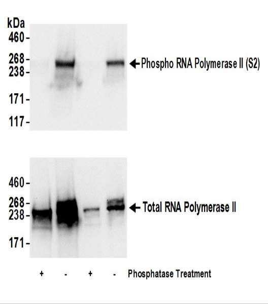 Anti-phospho-RNA Polymerase II (Ser2)