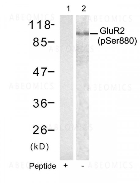 Anti-GluR2 (phospho-Ser880)