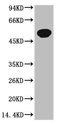 Anti-TUBB3 Monoclonal