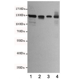 Anti-E-Cadherin, clone 6B10-F4-G10