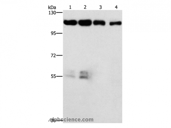 Anti-CDK11A/CDK11B