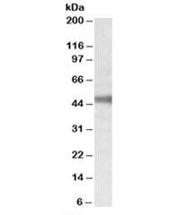 Anti-ATP1B1