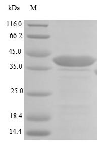 Laminin subunit beta-1 (LAMB1), partial, human, recombinant