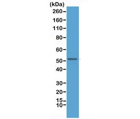 Anti-GFAP (N-Terminal), clone RM246 (recombinant antibody)