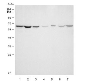 Anti-TKTL1 / Transketolase-like protein 1 / TKR