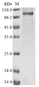 Small conductance calcium-activated potassium channel protein 2 (Kcnn2), rat, recombinant