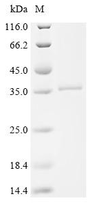 Cathepsin G (CTSG), recombinant human