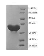 Carbonic anhydrase 1 (Ca1), rat, recombinant