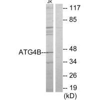 Anti-ATG4B