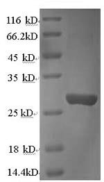 Cathepsin K (Ctsk), rat, recombinant