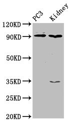 Anti-CDK11A