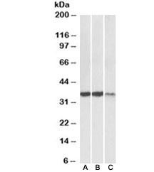 Anti-LDHA