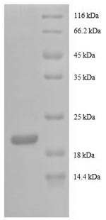 Granulocyte colony-stimulating factor (CSF3), partial, human, recombinant