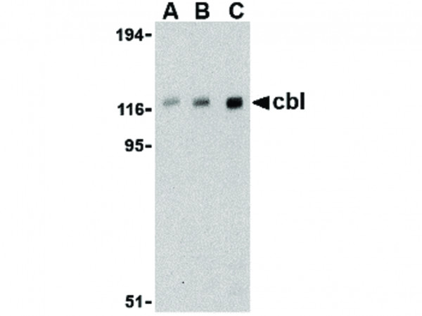 Anti-Cbl