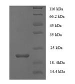 Secretory phospholipase A2 receptor (PLA2R1), partial, human, recombinant