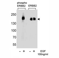 Anti-HER2 (ERBB2) (phospho-Y1127)