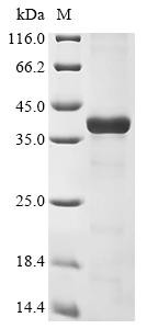 Histamine N-methyltransferase (Hnmt), mouse, recombinant