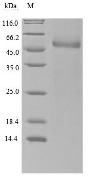 Retinol-binding protein 4 (RBP4) (Active), human, recombinant