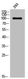 Anti-Phospho-PGR (S294)