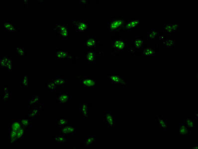 Anti-HIST1H1D (Ab-16)