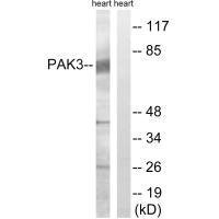 Anti-PAK3 (Ab-154)