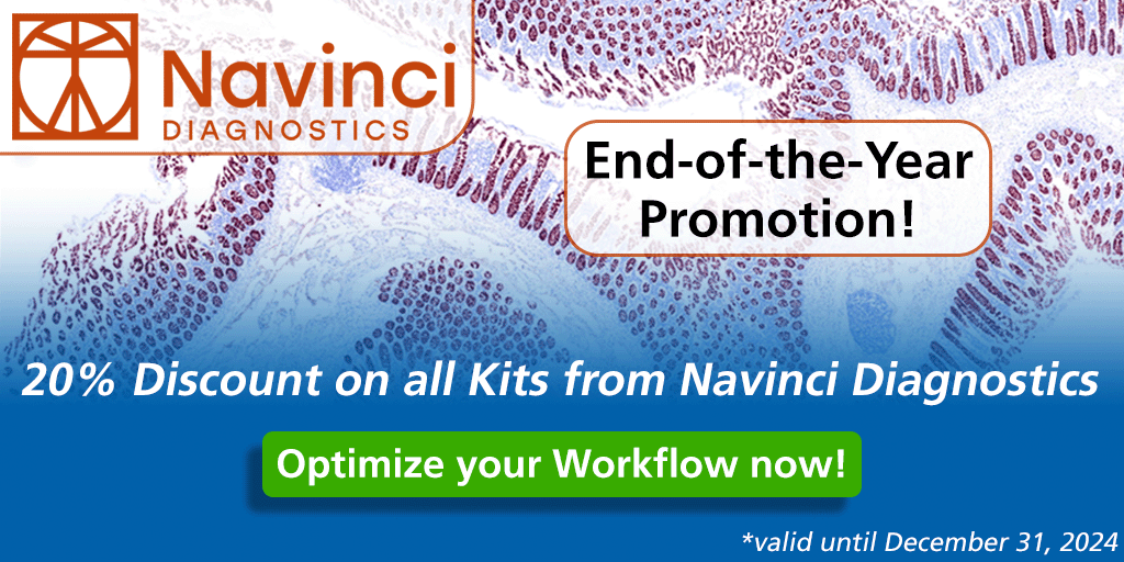 Navinci End-of-the-Year Promotion