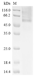 Glucosylceramidase (GBA), human, recombinant