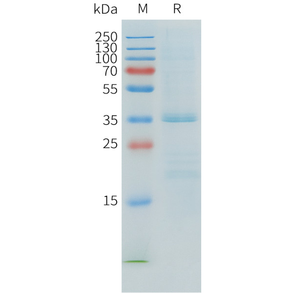 Human APOE4 Protein, His Tag