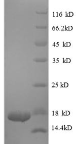 Transforming growth factor beta-1 proprotein (TGFB1), partial, human, recombinant