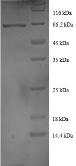 DnaJ homolog subfamily B member 1 (DNAJB1), human, recombinant