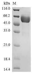 Hepatitis A virus cellular receptor 2 (HAVCR2), partial, human, recombinant