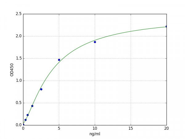 Human MT1E / Metallothionein-1E ELISA Kit