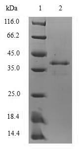 Protein S100-A8 (S100a8), mouse, recombinant